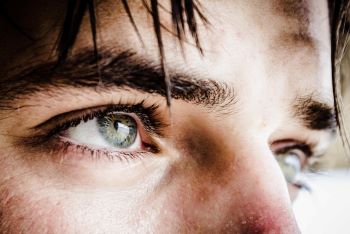 What to Expect After LASIK Eye Surgery