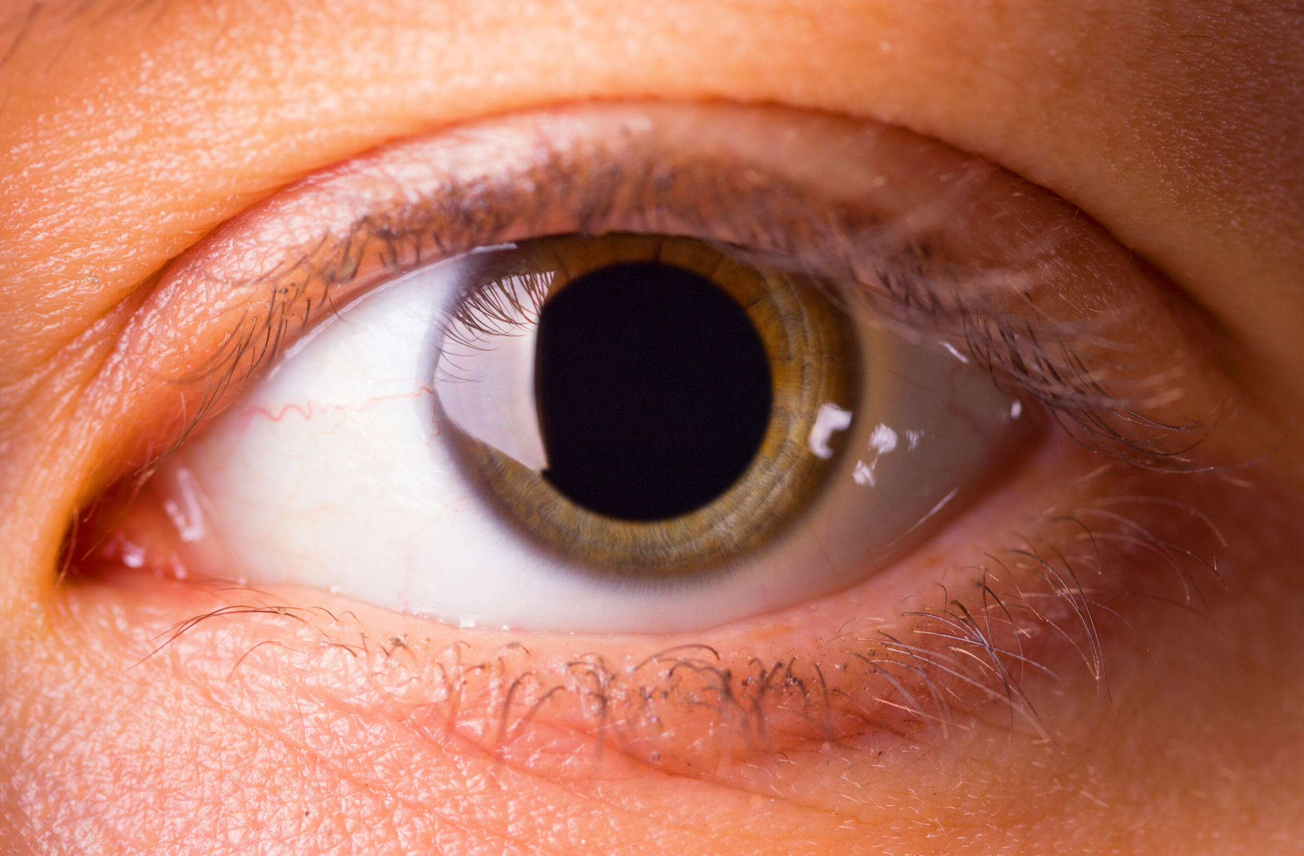 Understanding Eye Dilation: What to Expect During Your Eye Exam