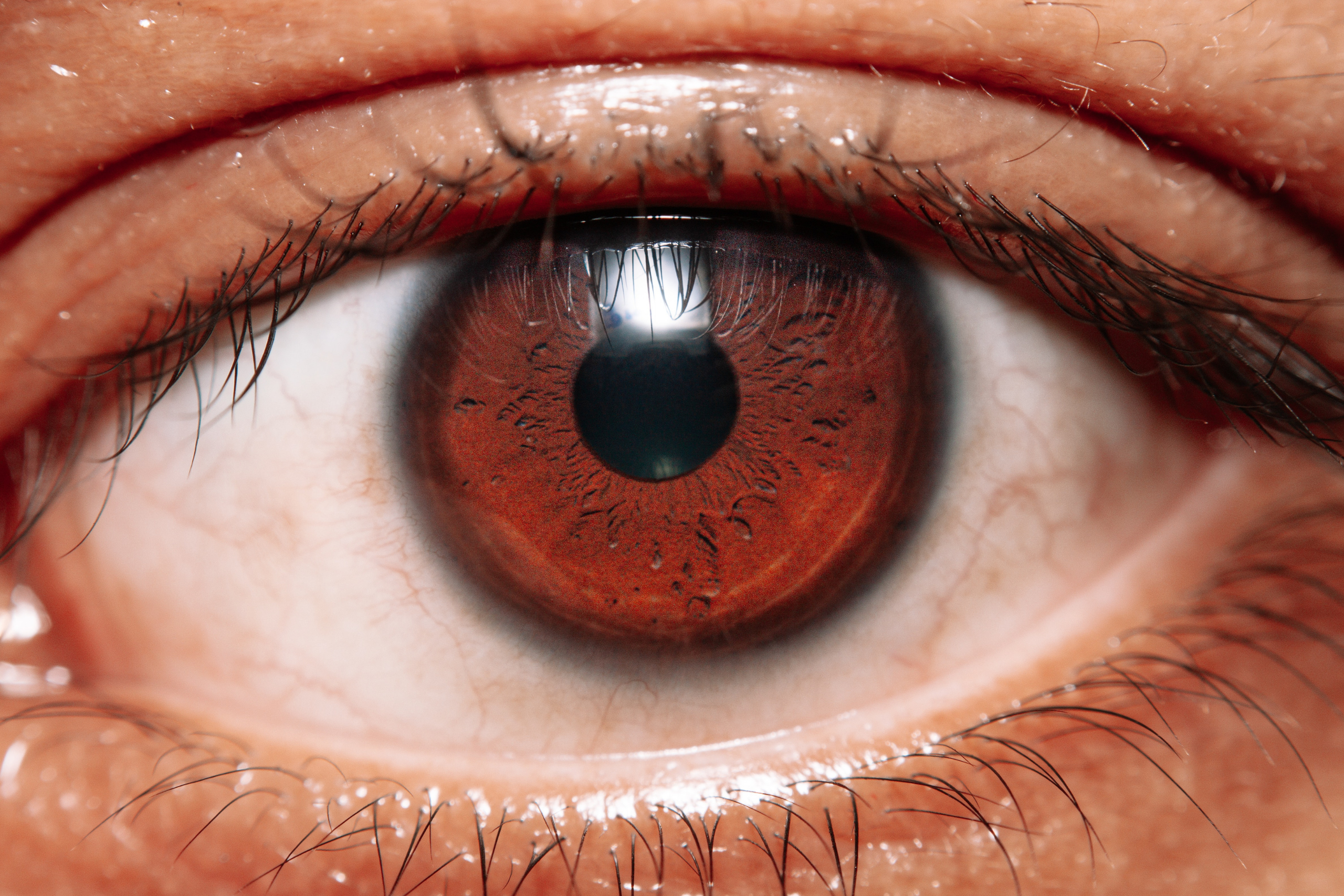 close up of person's eye, how much eye pressure is normal